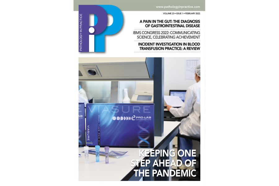 Keeping one step ahead of the pandemic