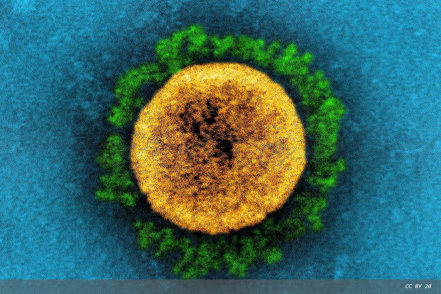 Two years since the launch of the first SARS-CoV-2 PCR test