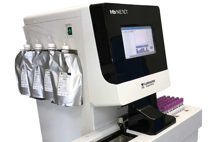 Next innovation in HPLC launched