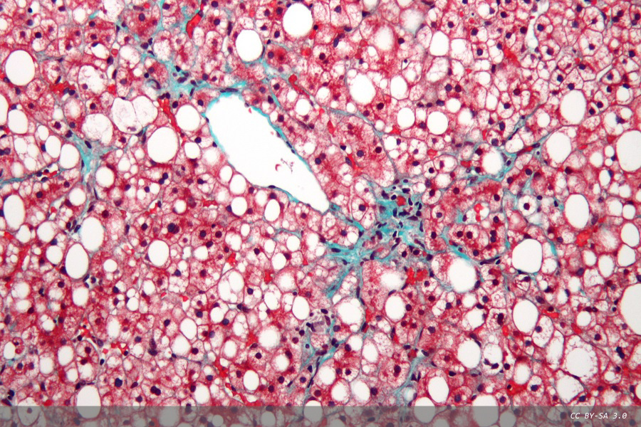 Introducing liver-on-a-chip technology