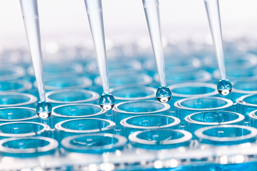 Proclarix introduced into Italian laboratory to assess prostate cancer