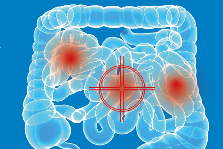 Updates in gastroenterology and hepatology