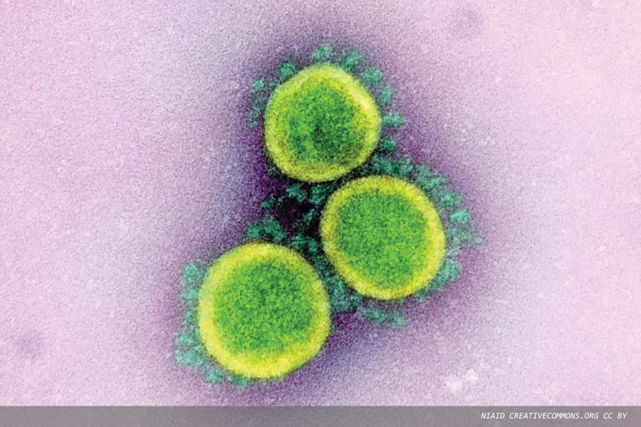 Two assays launched for the quantification of SARS-CoV-2 antibodies