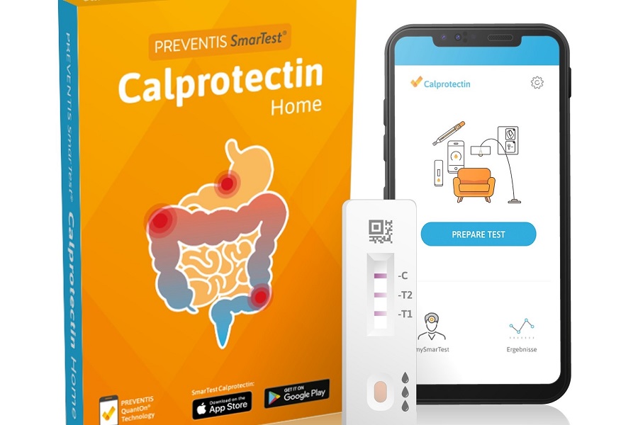 Home-testing option for inflammatory bowel disease patients