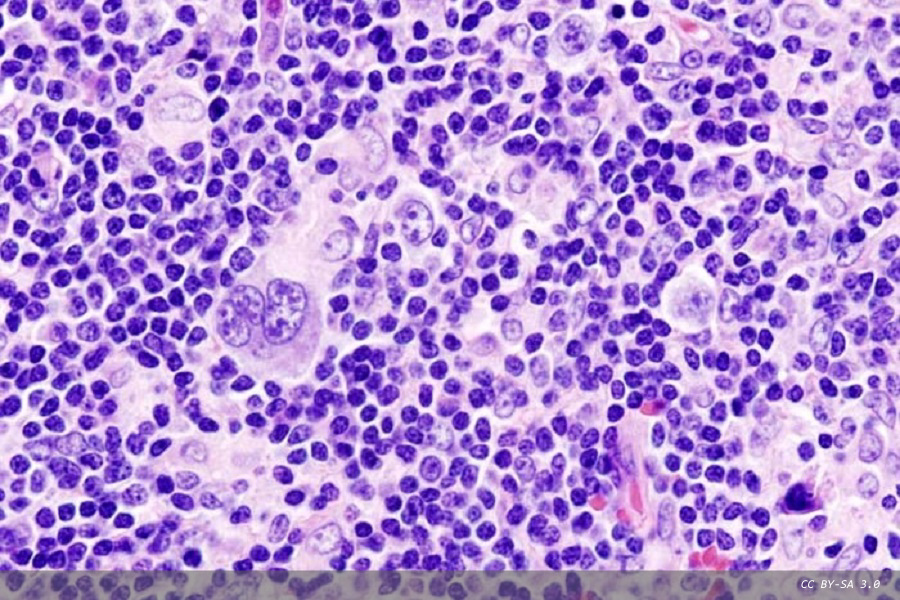 Anti-idiotypic antibodies for bioanalysis and drug monitoring 