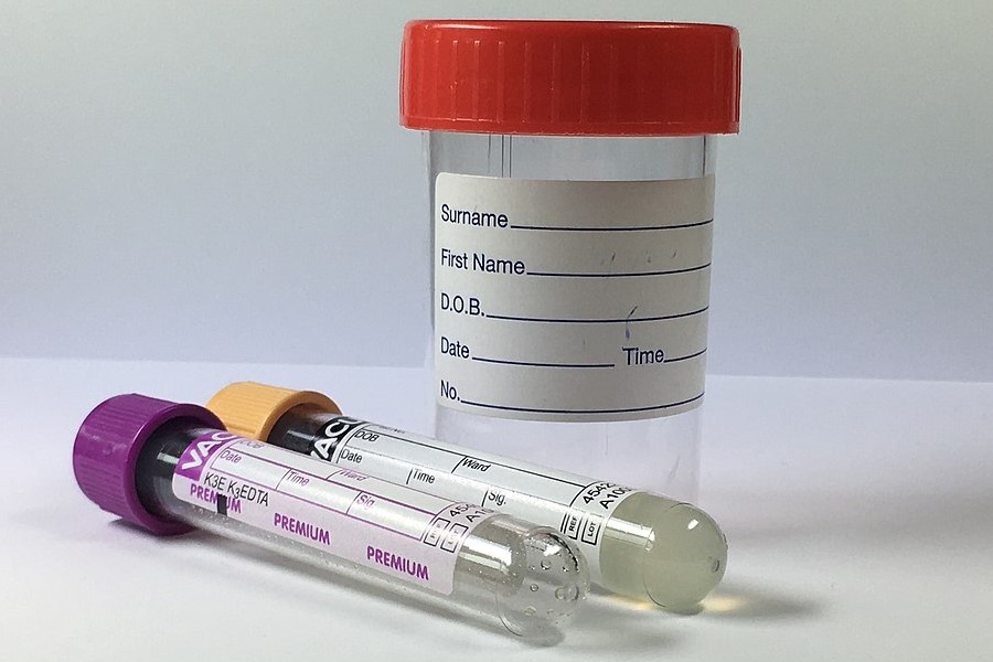 Head of East Lancs pathology hub project criticised by consultants