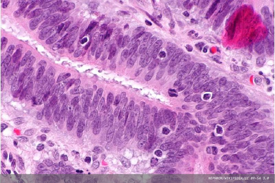 Guideline clarifies biomarker testing of multiple cancer types