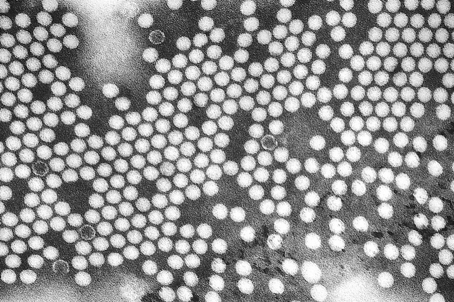 Poliovirus: a selection of open-access  research in the current literature