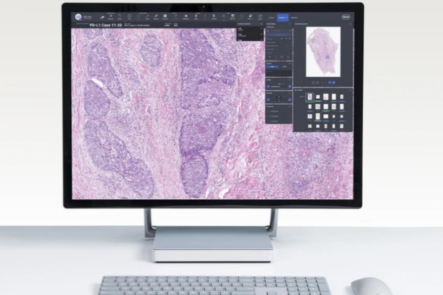 PathAI extends collaboration with Bristol Myers Squibb