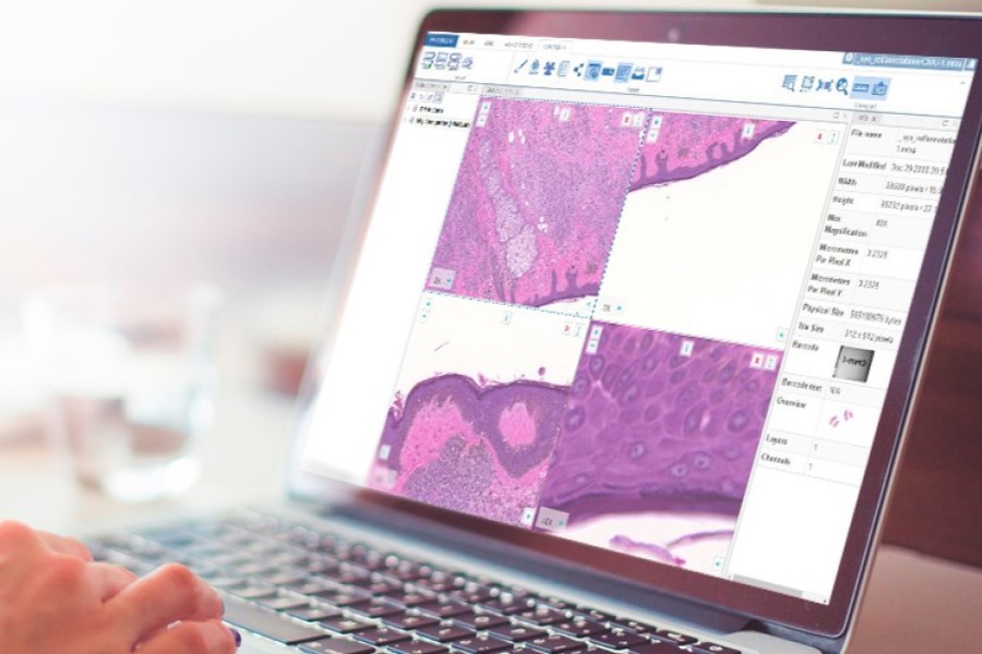 Pathomation announces new release of the ‘My Pathomation’ cloud platform for digital pathology