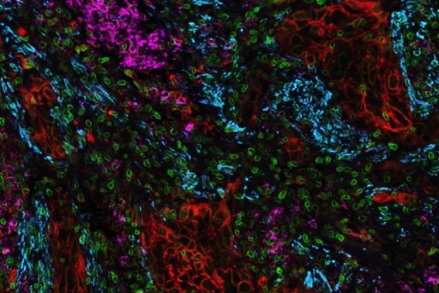 Lunaphore and Nucleai partner for AI-powered spatial biology analysis