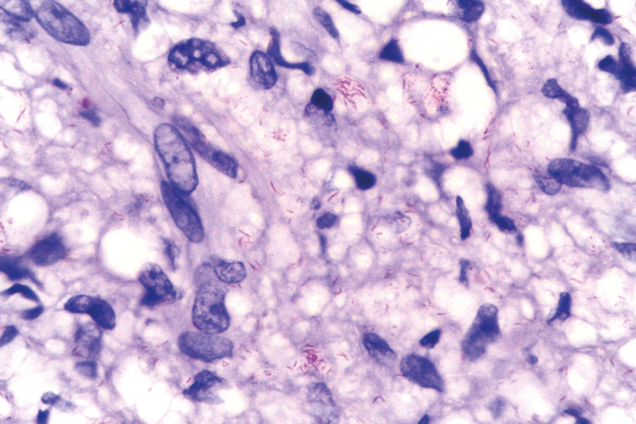 Staining for microorganisms:  a selection of current  research interest