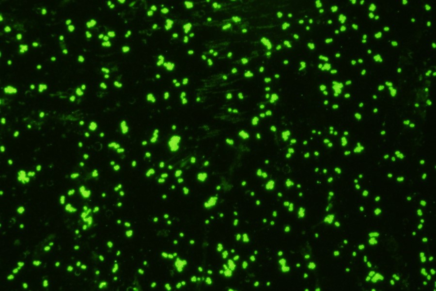 Rapid detection of Gram-negative bacteria