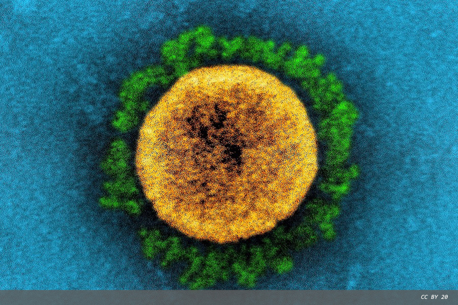 Roche introduces next-generation portfolio of SARS-CoV-2 rapid antigen tests
