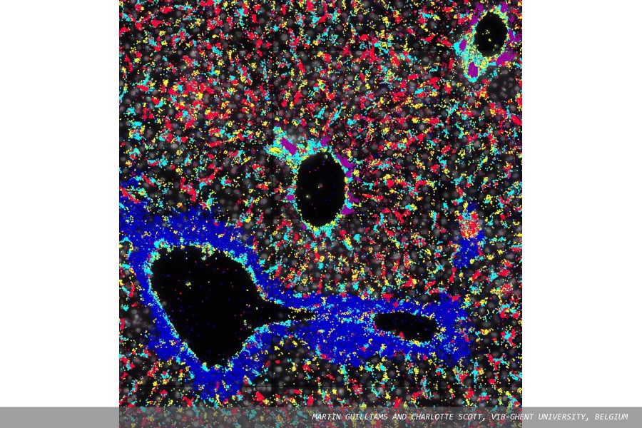 Resolve Biosciences secures funding to further develop Molecular Cartography workflow