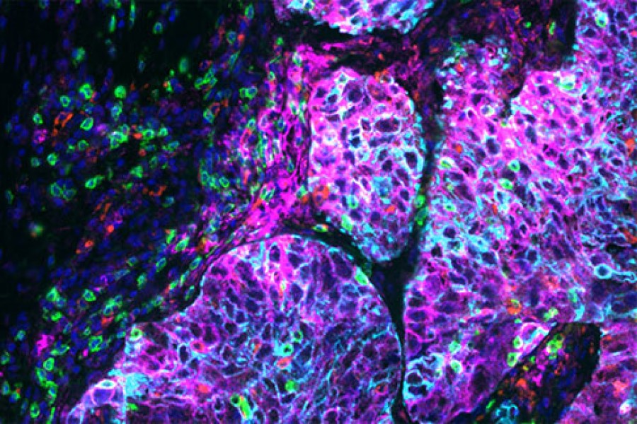 Evident and Ultivue collaborate to advance multiplex slide imaging