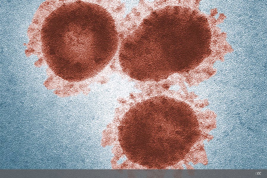 US NIH funds studies to advance rapid diagnosis of COVID-19-related inflammatory syndrome in children