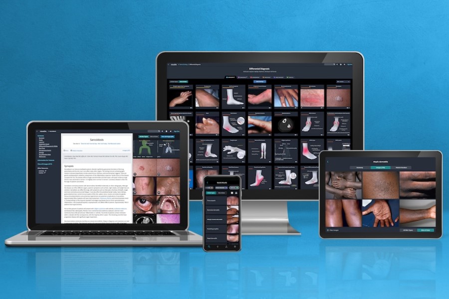 VisualDx awarded grant to advance diagnostic accuracy