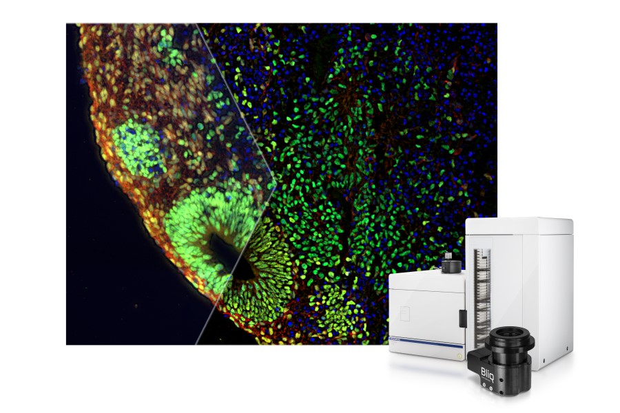 Slideview VS200 adds optical sectioning device for high-contrast, blur-free imaging