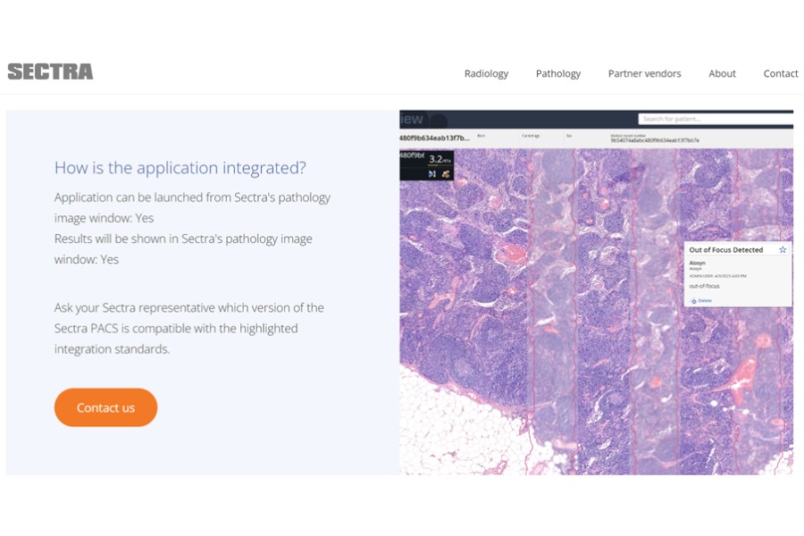 Aiosyn’s AI-powered QC for digital pathology now available in Sectra Amplifier Marketplace