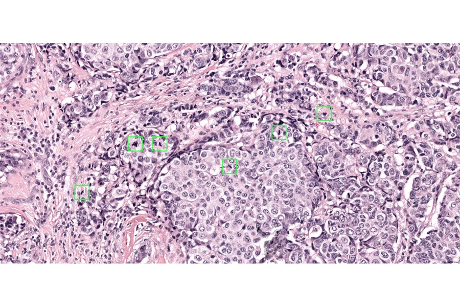 Aiosyn launches AI-powered mitosis detection solution