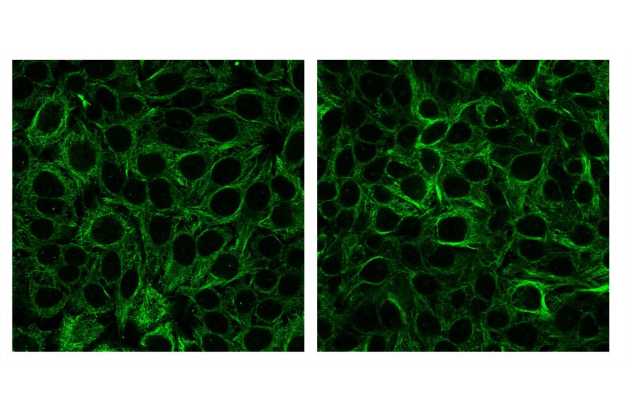 Biotium introduces labelling kits for IgM antibodies