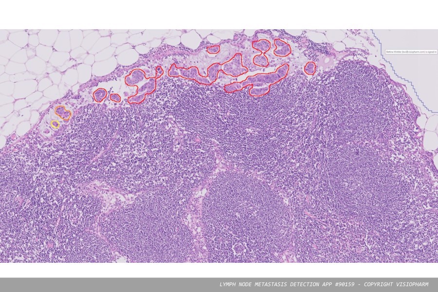 Evident announces alliance to automate digital pathology workflows