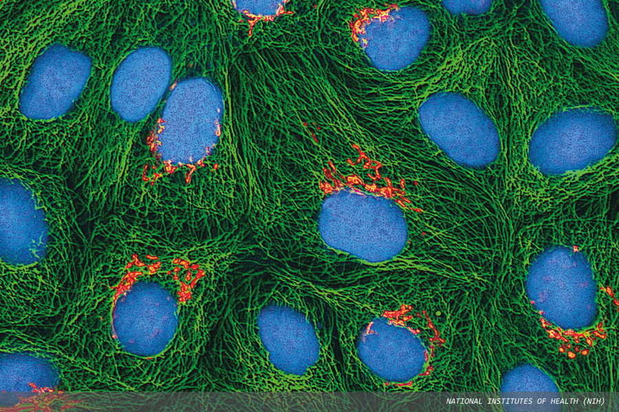 HeLa cell culture: a selection of current research using these immortal cells