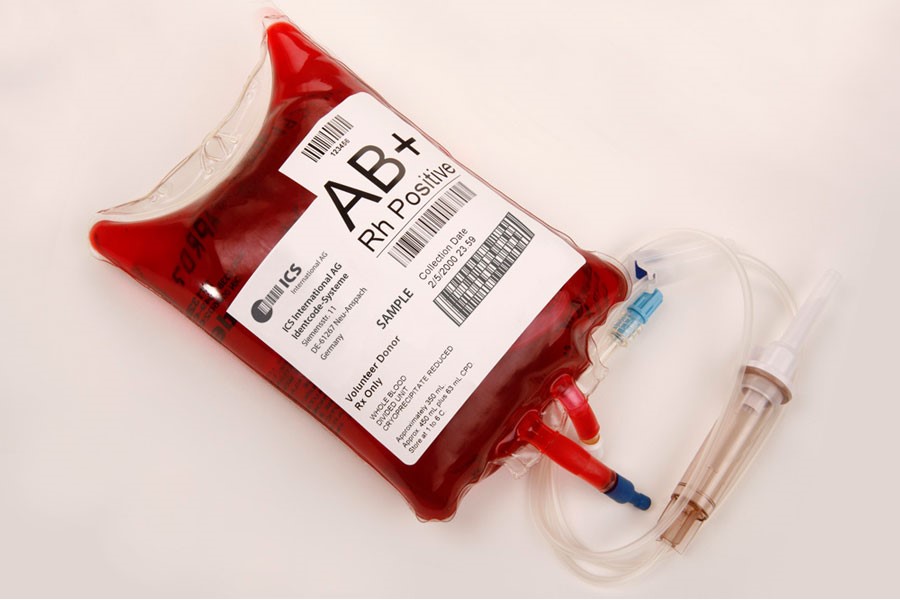 NHS offers inherited blood disorder patients world-first test to curb transfusion side effects