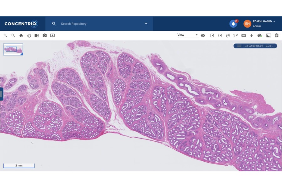 Proscia receives FDA 510(k) clearance for Concentriq AP-Dx