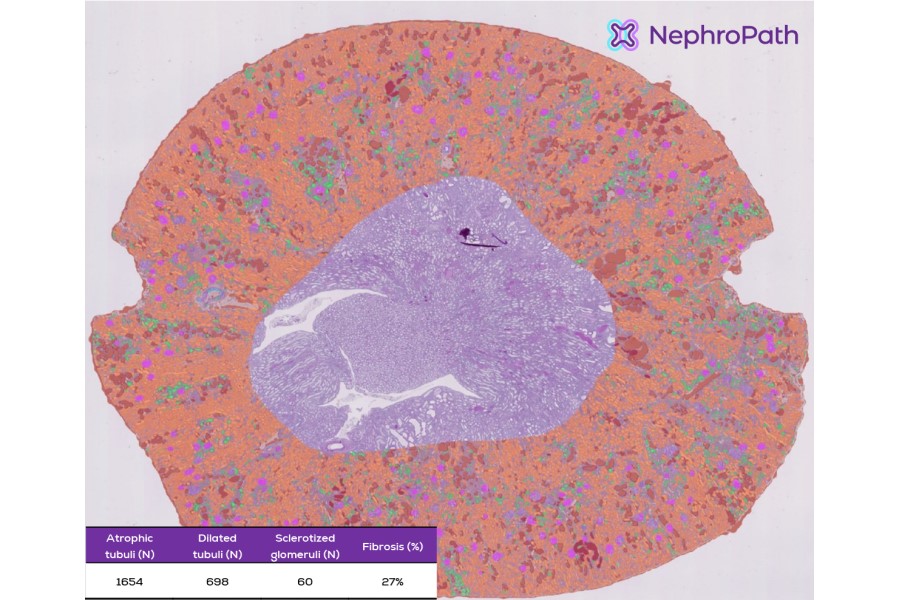 Aiosyn launches kidney image analysis services via NephroPath platform