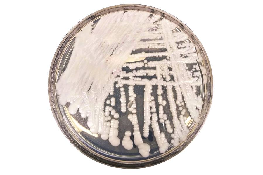 Candida auris: a selection of current research into this drug-resistant fungal pathogen