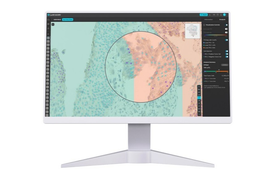 Lunit SCOPE AI enhances pathologist concordance and accuracy in HER2, ER, and PR assessment