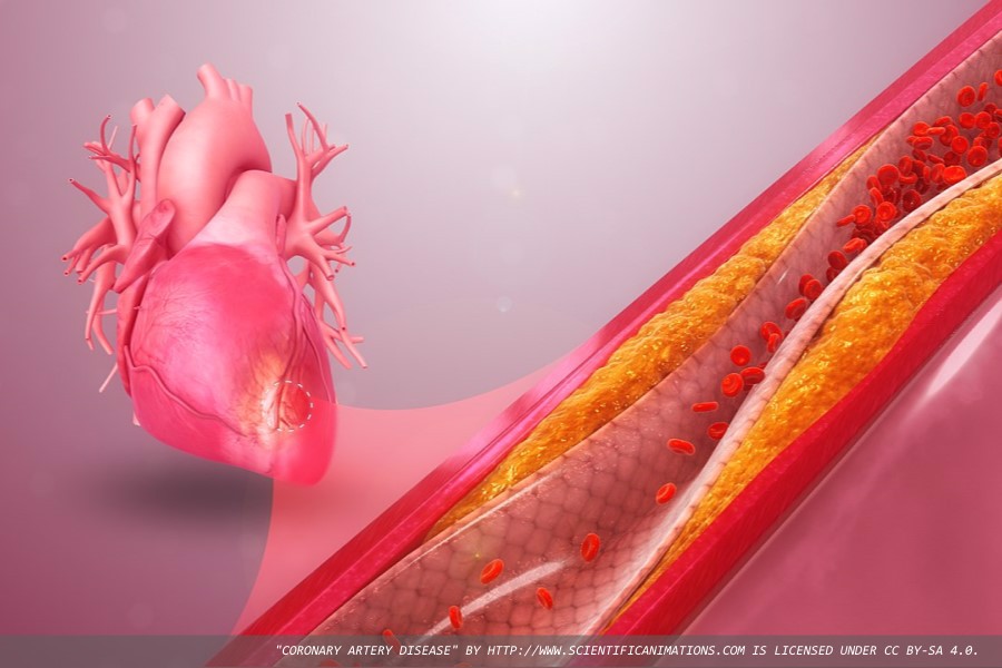 Potential novel biomarkers of coronary heart disease discovered