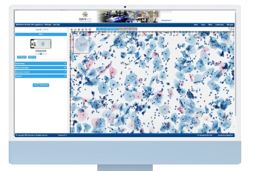 OptraSCAN launches new image management and storage solution