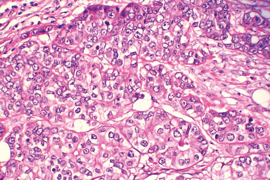 Digital pathology and artificial intelligence: a selection of research at the cutting edge of practice