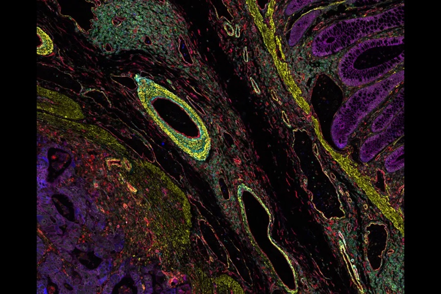 Latest Beacon research collaboration to build next generation of smart microscopes