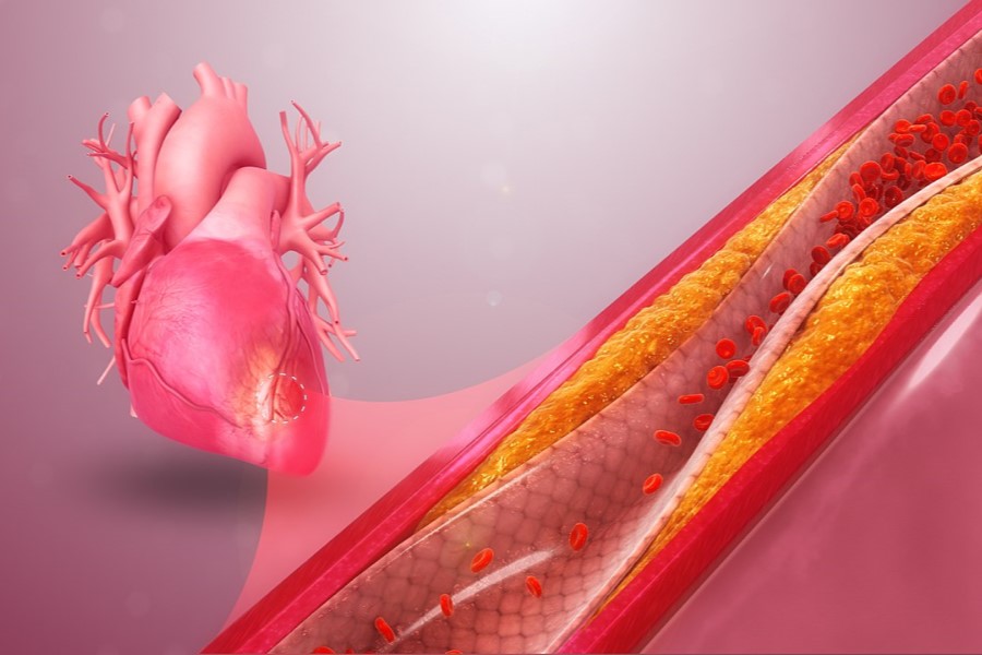 Novel point-of-care heart attack test leads to shorter emergency department stays