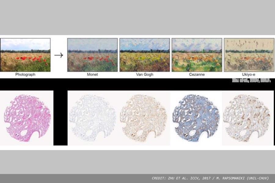 Generative AI takes on clinical predictions in cancer