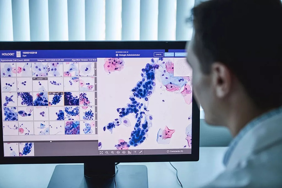 IBMS and Hologic collaborate on new digital cytology report
