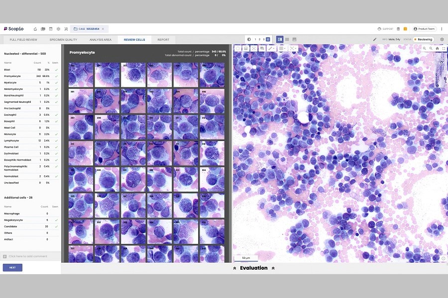 Digital bone marrow imaging and analysis added to Beckman Coulter and Scopio Labs partnership