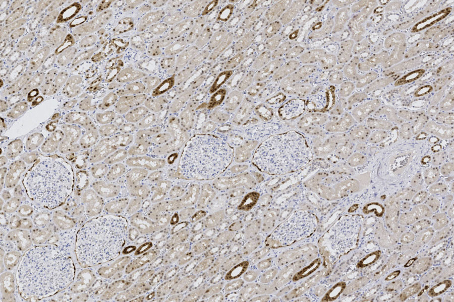 New system offers consistent, optimal IHC staining results