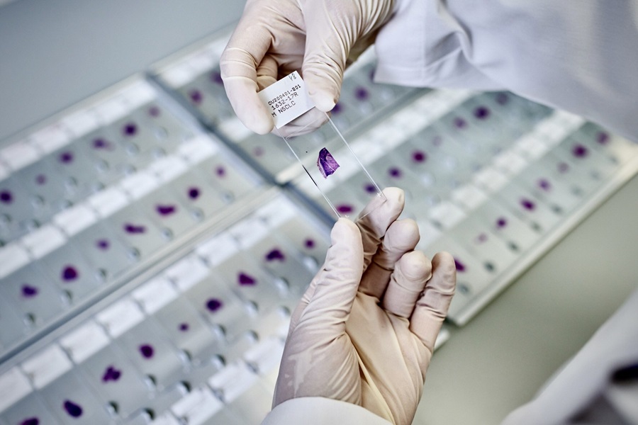 Lunit and AstraZeneca partner for AI-powered digital pathology cancer tools