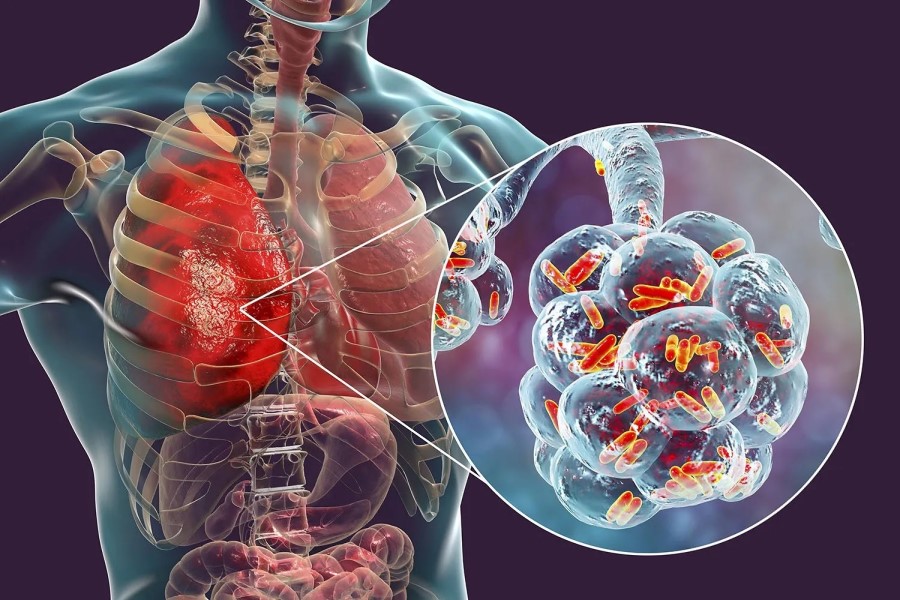 AMR: Glox Therapeutics awarded £1M PACE grant to develop new antibiotics