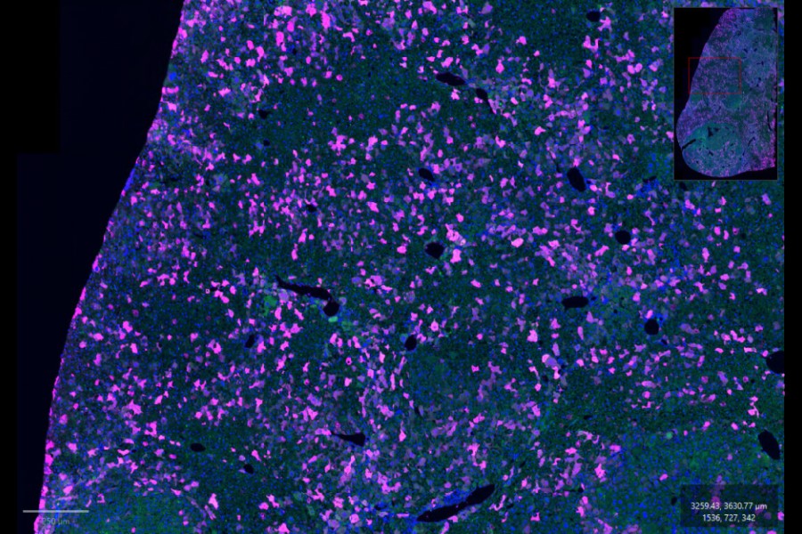 New anti-GFP antibodies from Jackson ImmunoResearch
