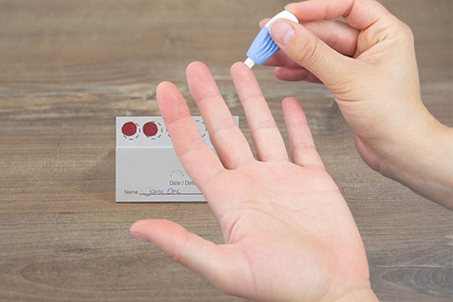 Novel measles antibody detection assay