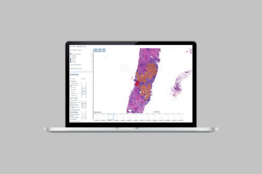 Aiforia and Orion extend collaboration to preclinical study evaluations