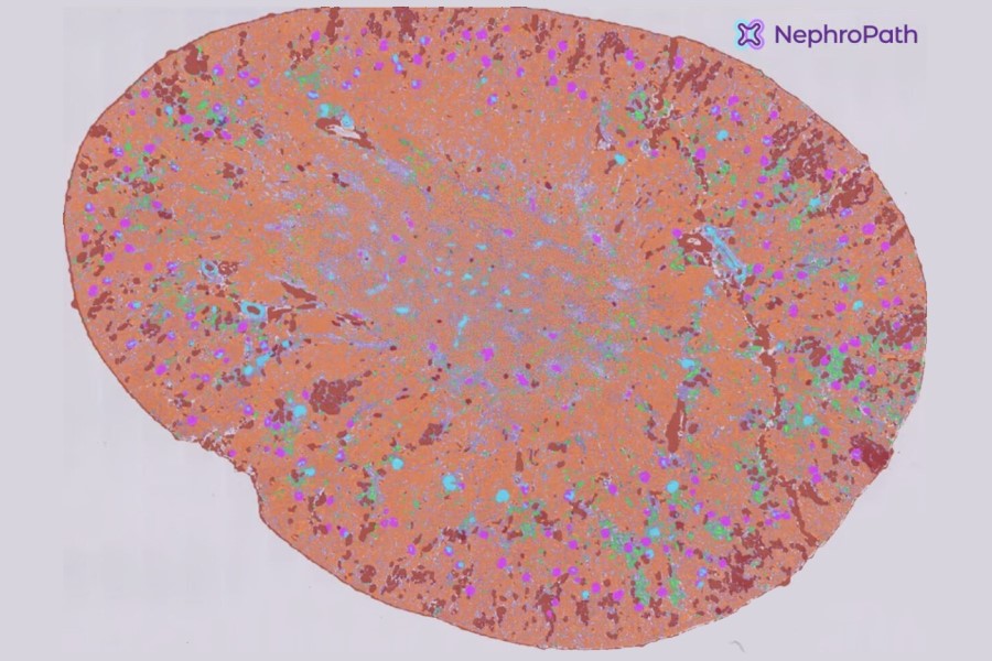 Real-time AI processing for kidney biopsy assessments