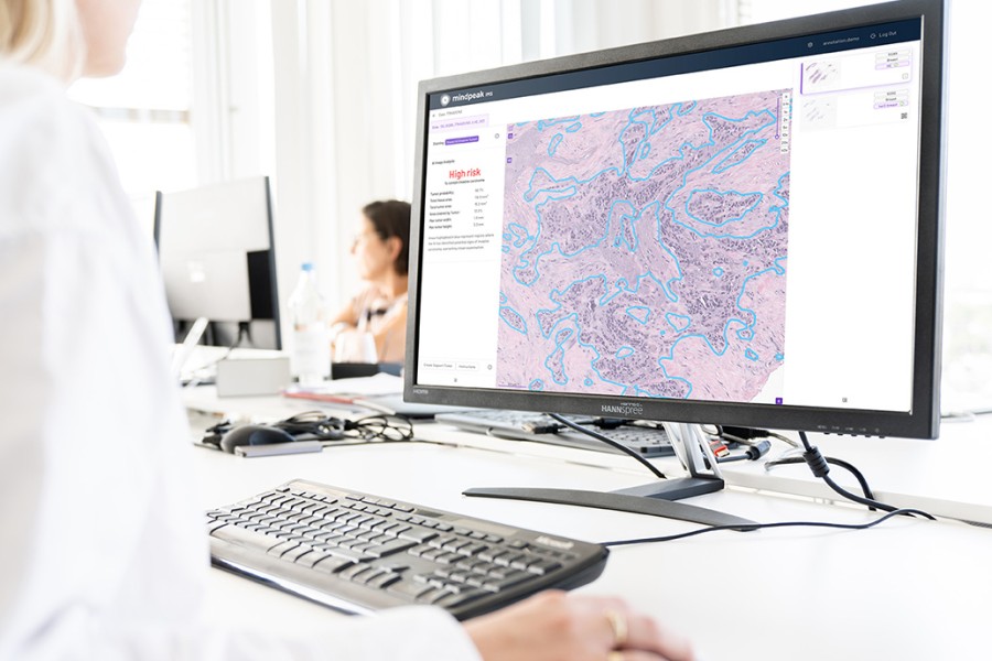 Partnership to advance AI-powered breast cancer risk assessment