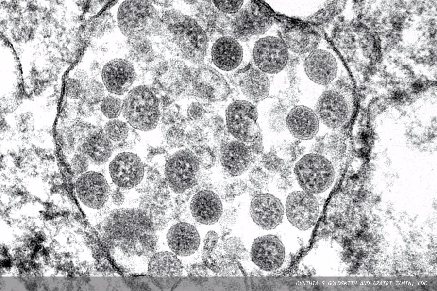 UKHSA highlights pathogens of greatest risk to public health